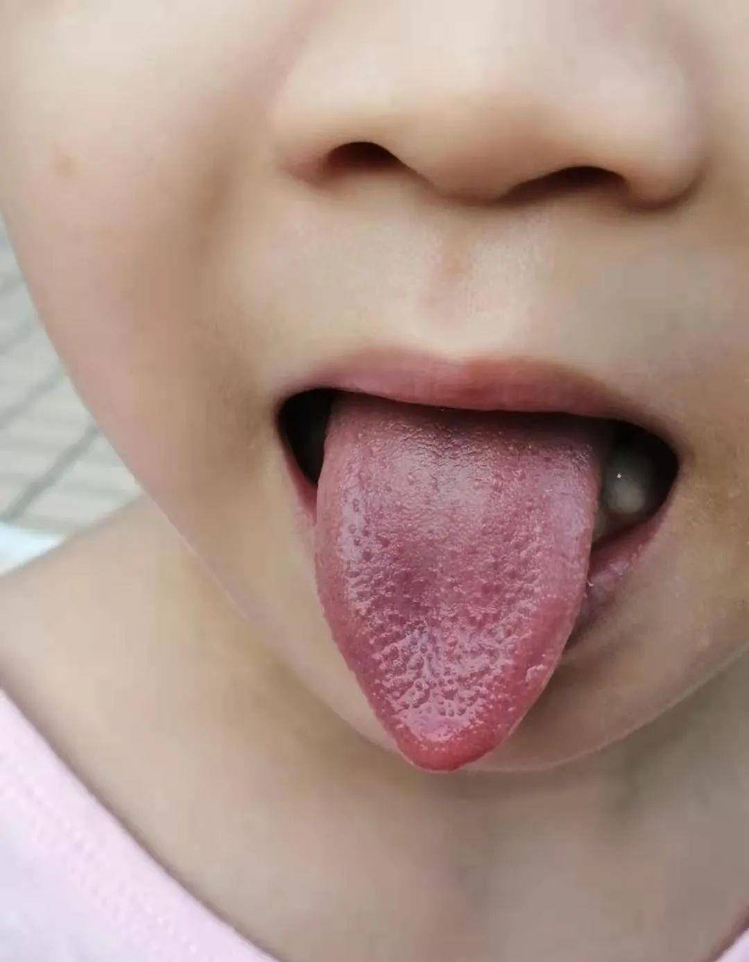 总拉羊屎蛋总便秘,用食疗给肠道补点津液_孩子_黄豆汤_肝气