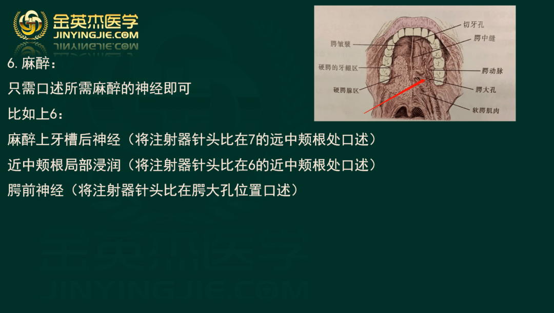 口腔 拔牙钳认识 考试口述版_上颌_下颌_注射器