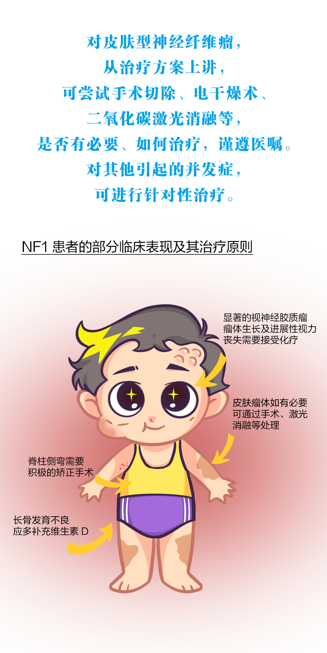 图说nf1 · 第2期 | 治疗Ⅰ型神经纤维瘤病,我们有这些办法!