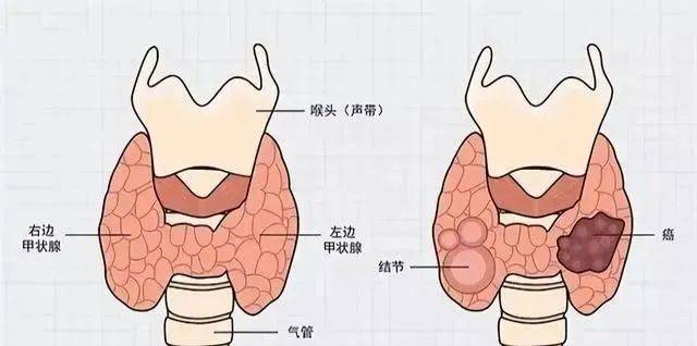 脖子和颈部示意图图片