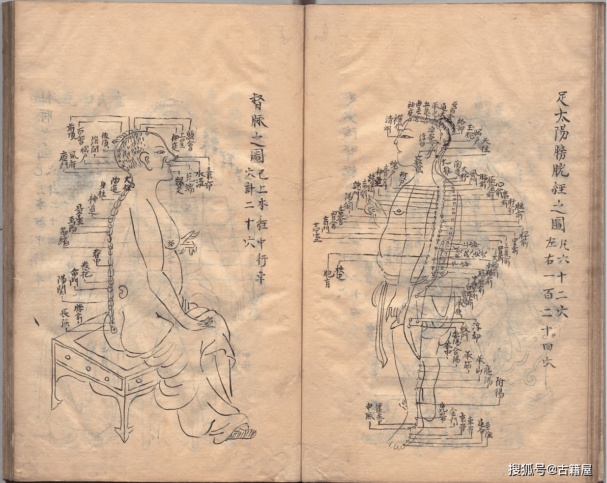 中医针灸著作《鼎雕铜人腧穴针灸图经》明抄本