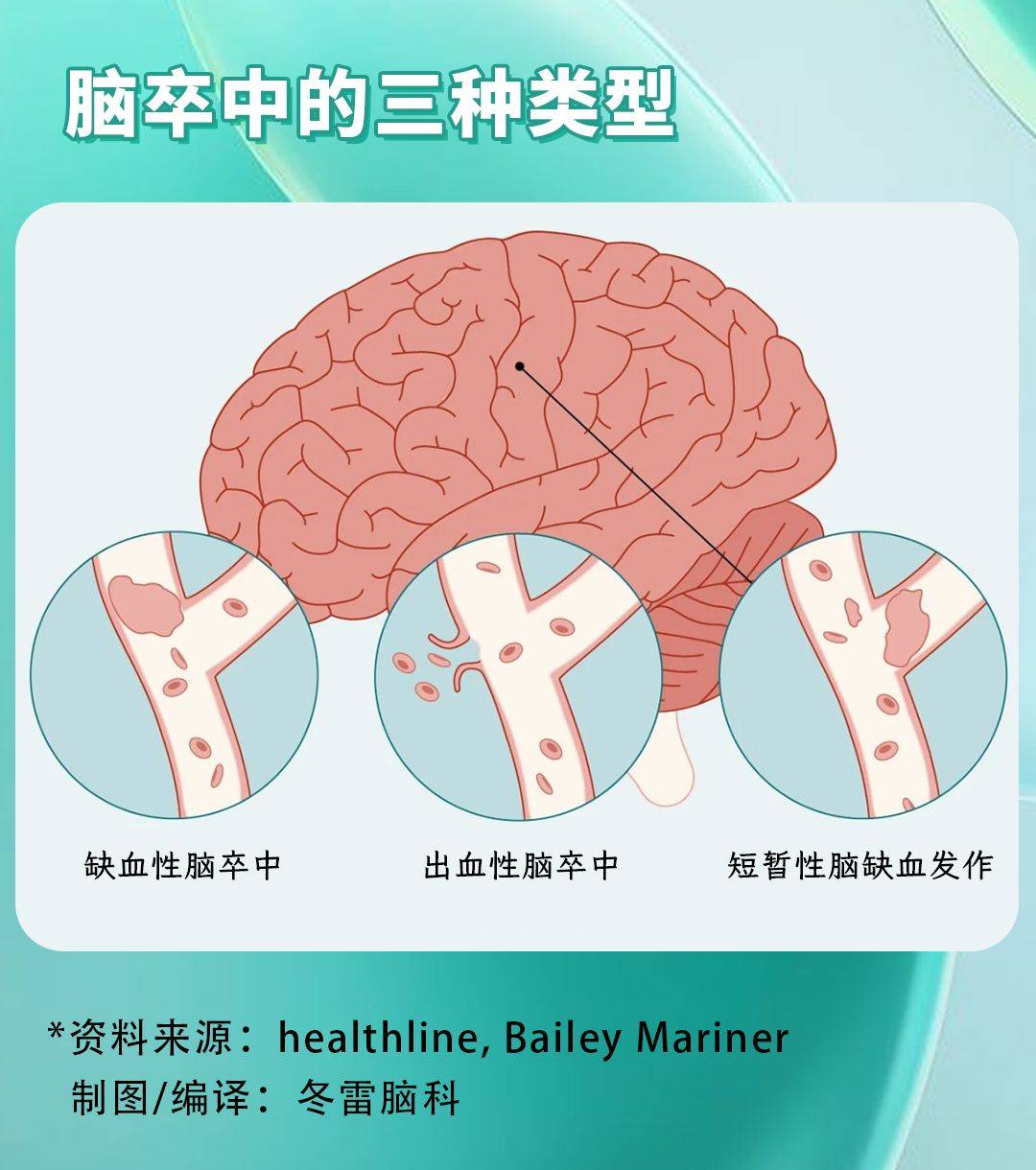 腦卒中的一級預防是指針對疾病發生的預防.