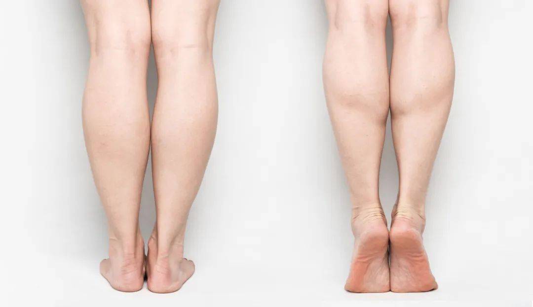 你的走路姿势,可能一直都错了!难看还伤腿!