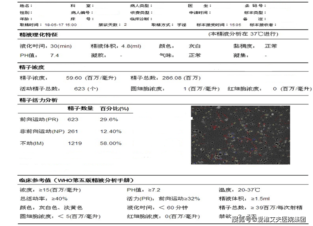 精子分析报告单参考值图片