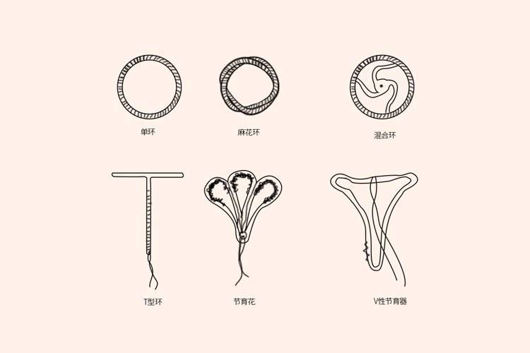 我國主要使用的節育環有三種,一是帶銅t型節育器,使用年限一般為5～8