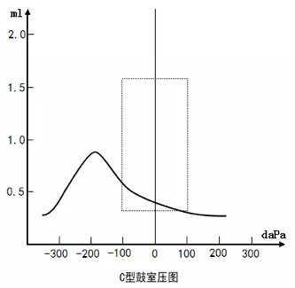 声导抗测试正常值图片