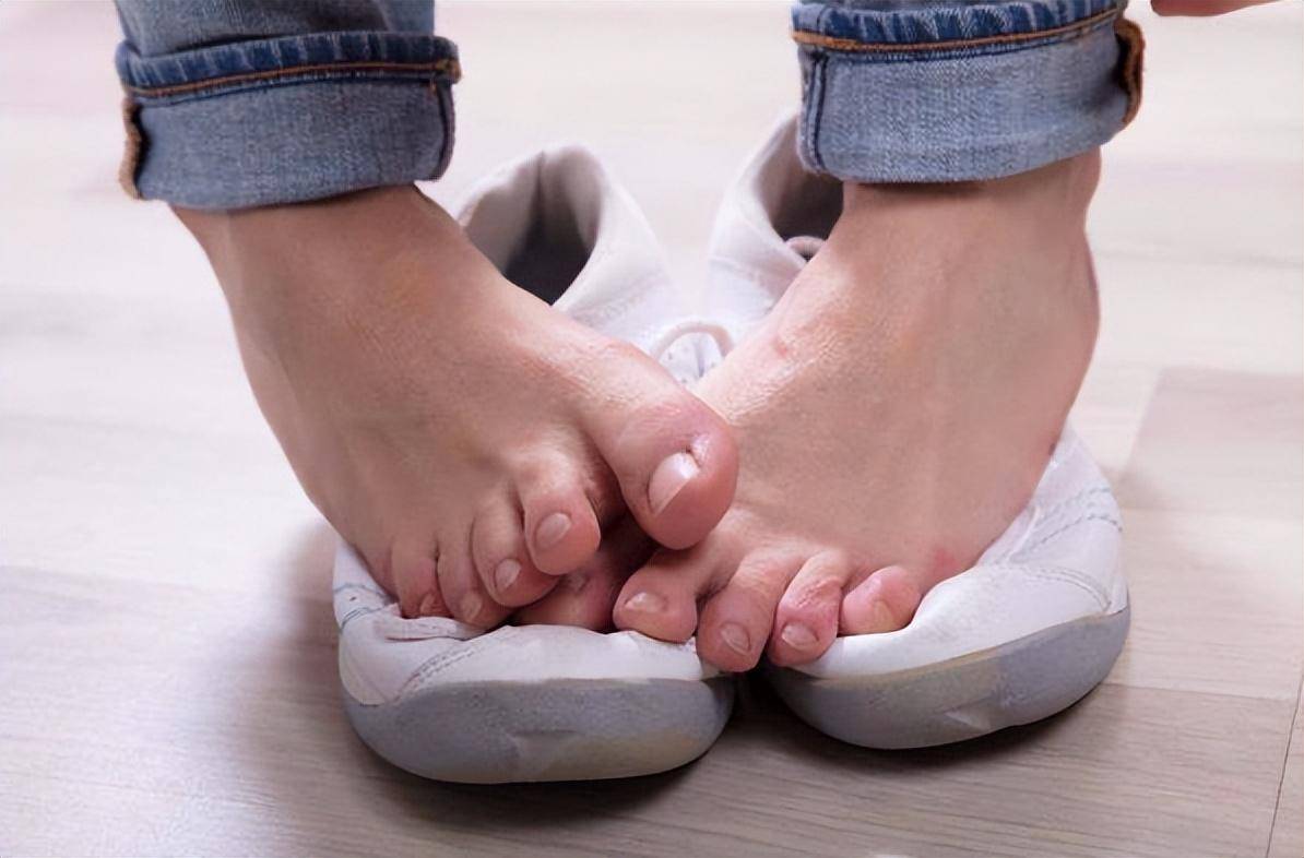 3,足癣:是由真菌感染引起的皮肤病之一,从而引起红斑,脱屑,异味等症状