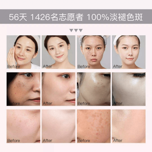 淡斑紧致抗皱的护肤品，618红榜锁定这几款！-淡斑抗皱护肤品排行榜