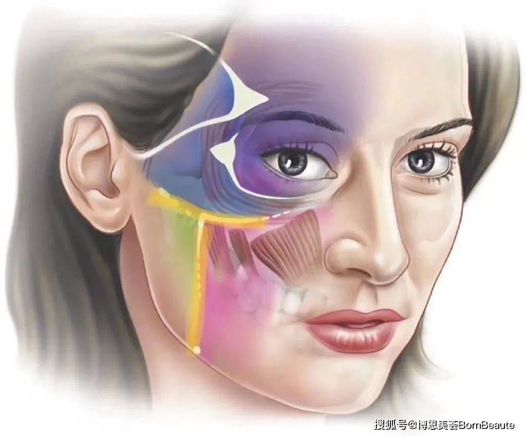 面中部凹陷和印第安纹有什么关系?_韧带_面部_组织