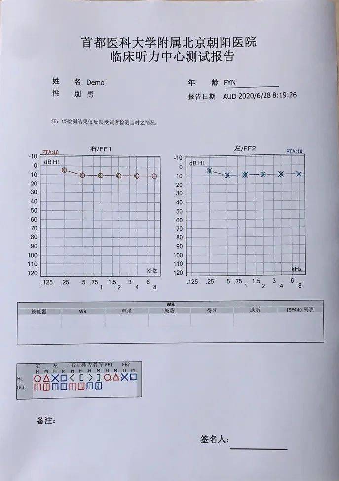 纯音测听正常值图图片