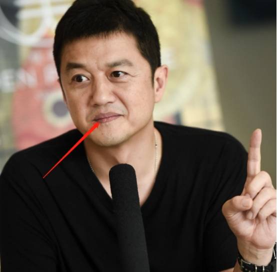 术后地包天眼神显凌厉,网友:越来越像李亚鹏_王菲_生活_缘故