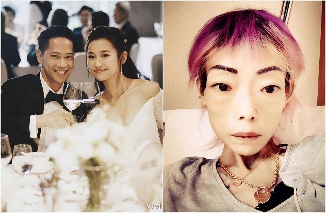 "最惨阔太"伍智恒:8年瘦到44斤,牙齿掉光,色衰被弃_郭永_老公_男友