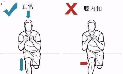 外展肌群薄弱的表现?_膝关节_体态_现象