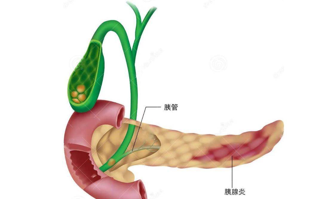 保护胰腺