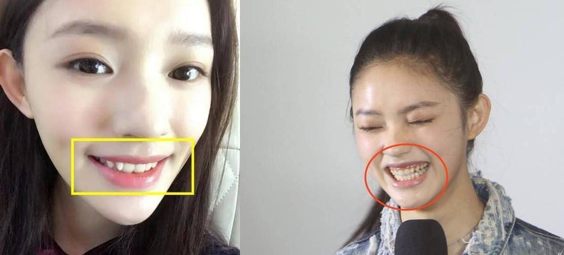 林允颜值变化史:高美商逆袭,堪称隐藏的骨相王者_感觉_进行了调整