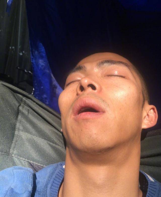 他在《我不是药神》中演彭浩,从非主流的黄毛到短发让人印象深刻_章宇