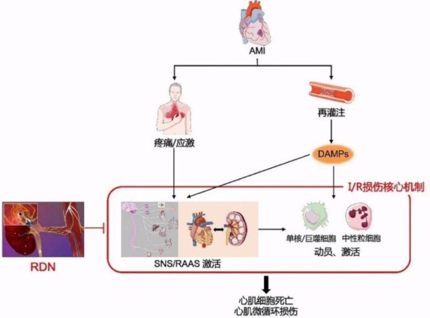 徐标教授:炎症调控与心肌缺血再灌注损伤
