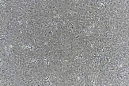 如何培养hacat人永生化角质形成细胞?