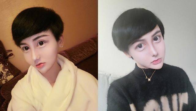 刘梓晨融掉玻尿酸脸垮了,补打了80针后长这样_芭比_样子_什么