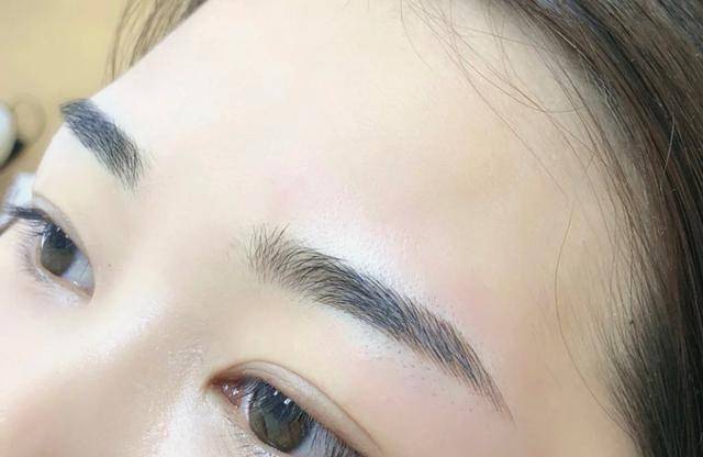 提前了解这些注意事项,效果会更自然好看_眉毛_项目_伤口