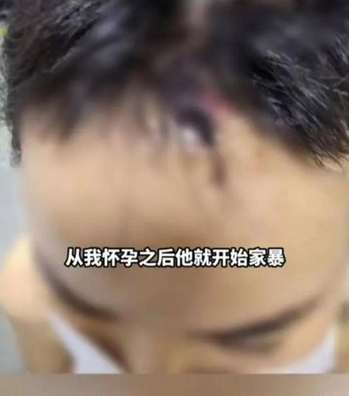 四川成都女子2年被家暴16次,多器官受损挂粪袋,呼吁严惩丈夫_谢女士