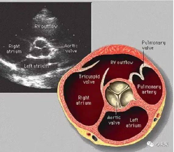 cardiac echocardiography)是一项经股静脉进入心腔,通过导管扫描心腔