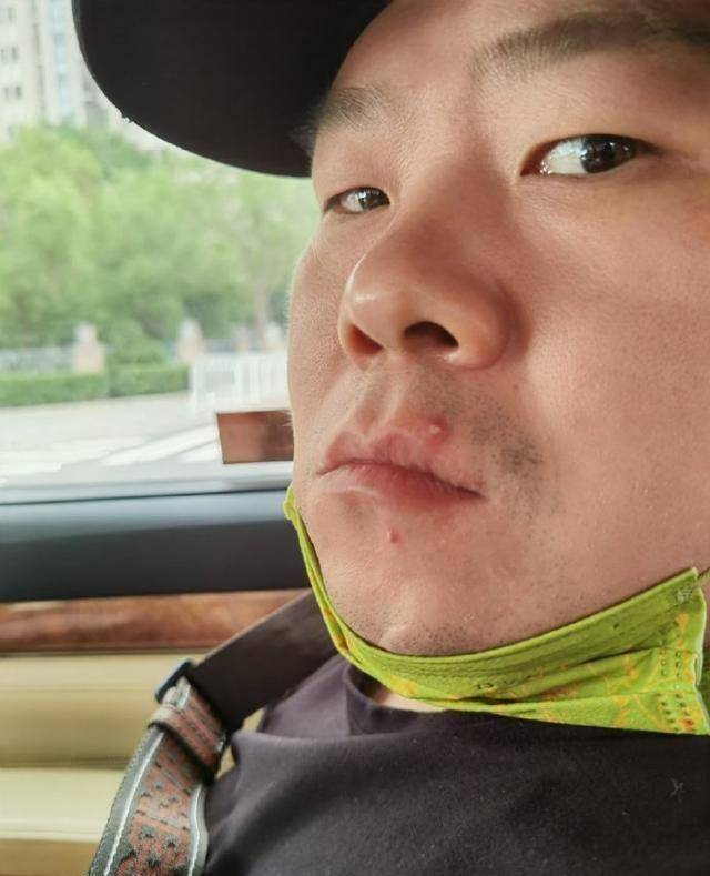 岳云鹏最大的黑粉竟然是自己的老婆?