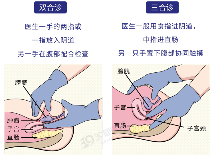 同时男医生的手普遍更大更长,在女性的盆腔检查项目中(双合诊/三合诊)