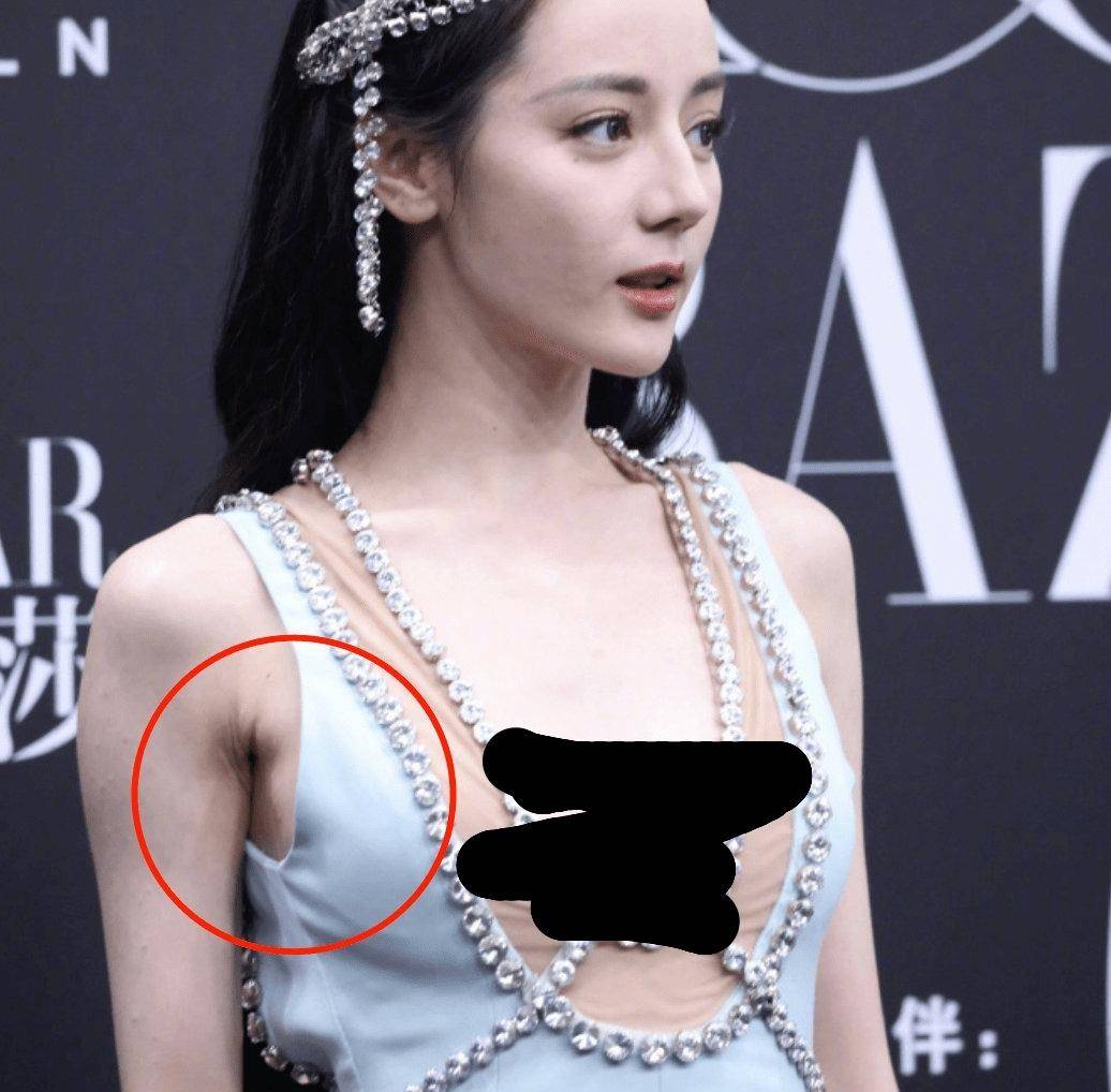 这还只是第二个,尤其是很多女生穿背心,吊袜带,腋下如果不好好对待