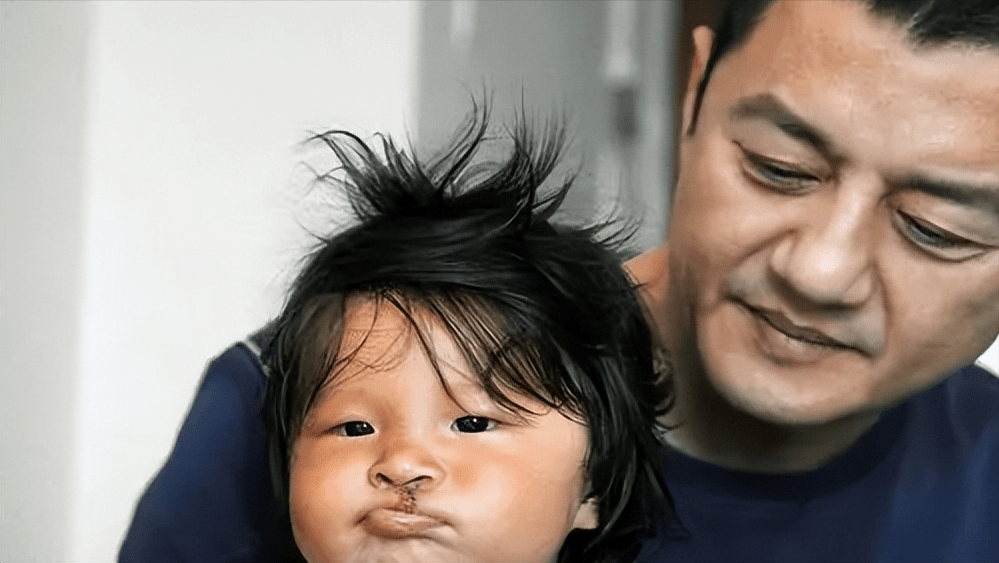 李亚鹏小女病情加重?