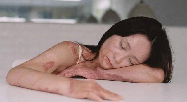 周岩:因拒绝富二代追求,花季少女被烧伤毁容,富二代结局如何?