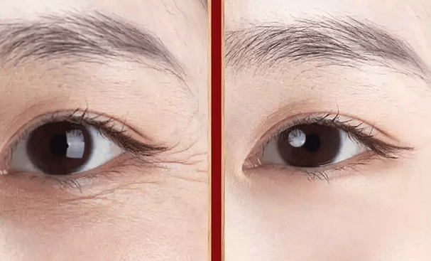 抗皱去皱最好方法?抗皱纹抗衰老的护肤品哪个牌子好十大排行榜?