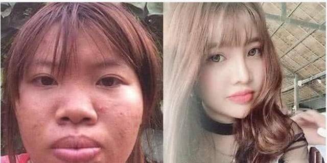 "越南凤姐"郭金凤:在相亲市场惨遭羞辱后,通过整容得到爱情!