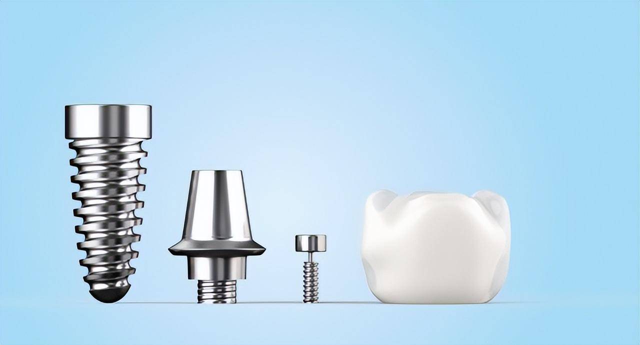 种植牙也会患牙周病吗?_患者_牙齿_效果