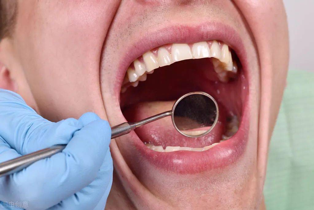 痛苦难耐得舌头疼,拿什么拯救你,灼口综合征?_更年期_感觉_综合症