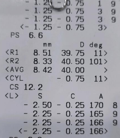 近视散光矫正已经初见成效,我家都做了啥?_孩子_度数_视力