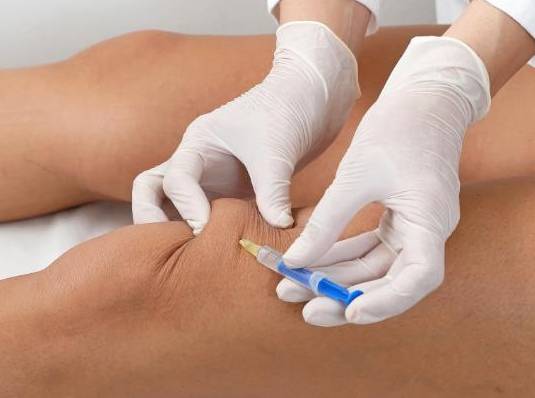 打封闭针的适应症和禁忌症有哪些?_治疗_局部_患者