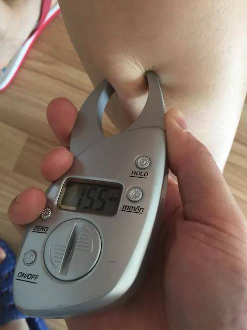 可以像下图所示测量并记录小腿不同部位的皮脂厚度,我有一篇文章还在