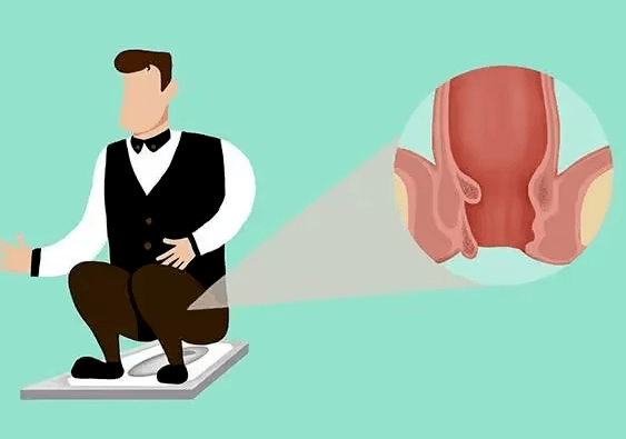 如何预防痔疮这种情况的发生?_肛门_部位_时间