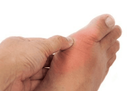 硫辛酸片:警惕!糖尿病神经病变可最终导致糖尿病足的发生!