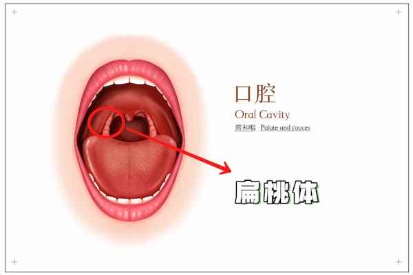 腺样体切除手术需要切除扁桃体吗