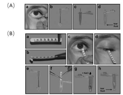 schirmer strip法用滤纸收集泪液时,将滤纸在下眼睑结膜囊内放置5分钟
