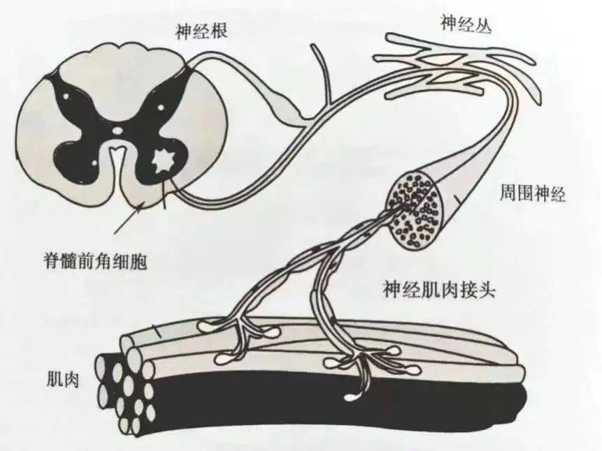 让神经,肌肉"告诉"你答案!_病变_part_综合征