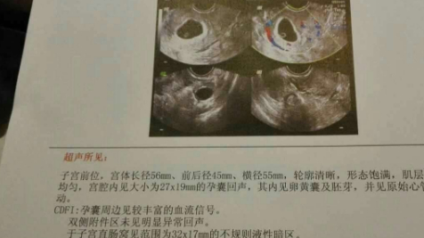 孕期,孕检报告若有这3个消息,或许可以恭迎"小阿哥