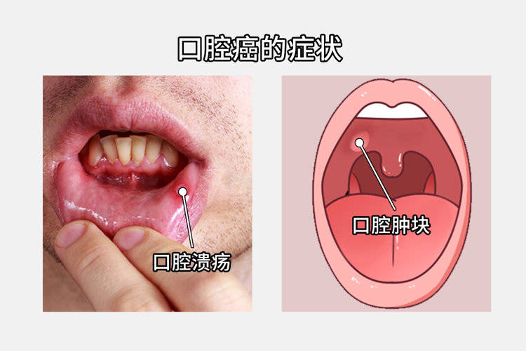 综合了当前的科学证据,得出了一个显著的结论:饮茶可能对预防多种癌症