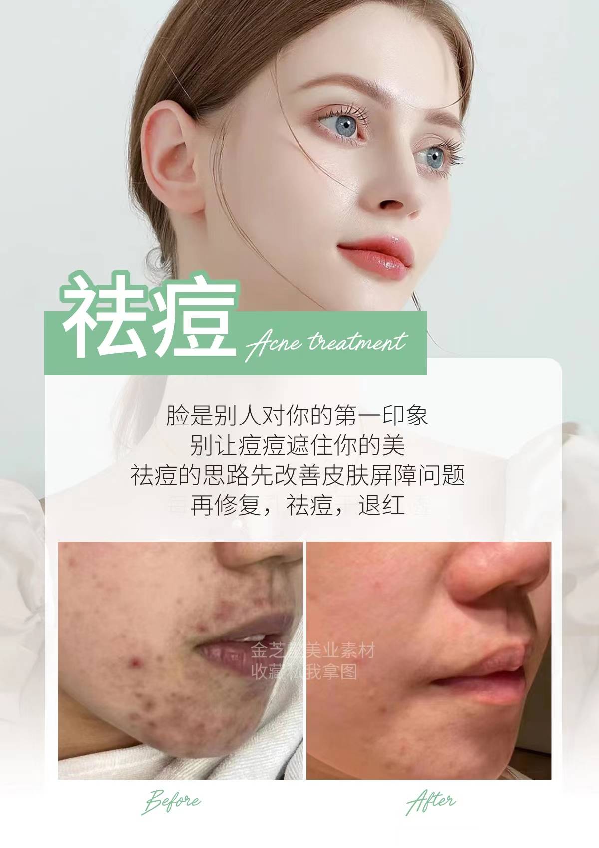 祛痘朋友圈高级文案,不要忽略肌肤的"烦恼"_痘痘_护理_皮肤