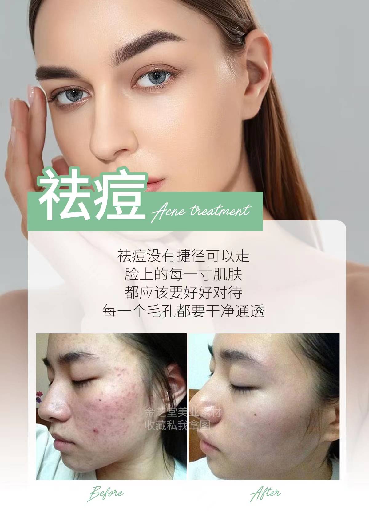 祛痘朋友圈高级文案,不要忽略肌肤的"烦恼"_痘痘_护理_皮肤