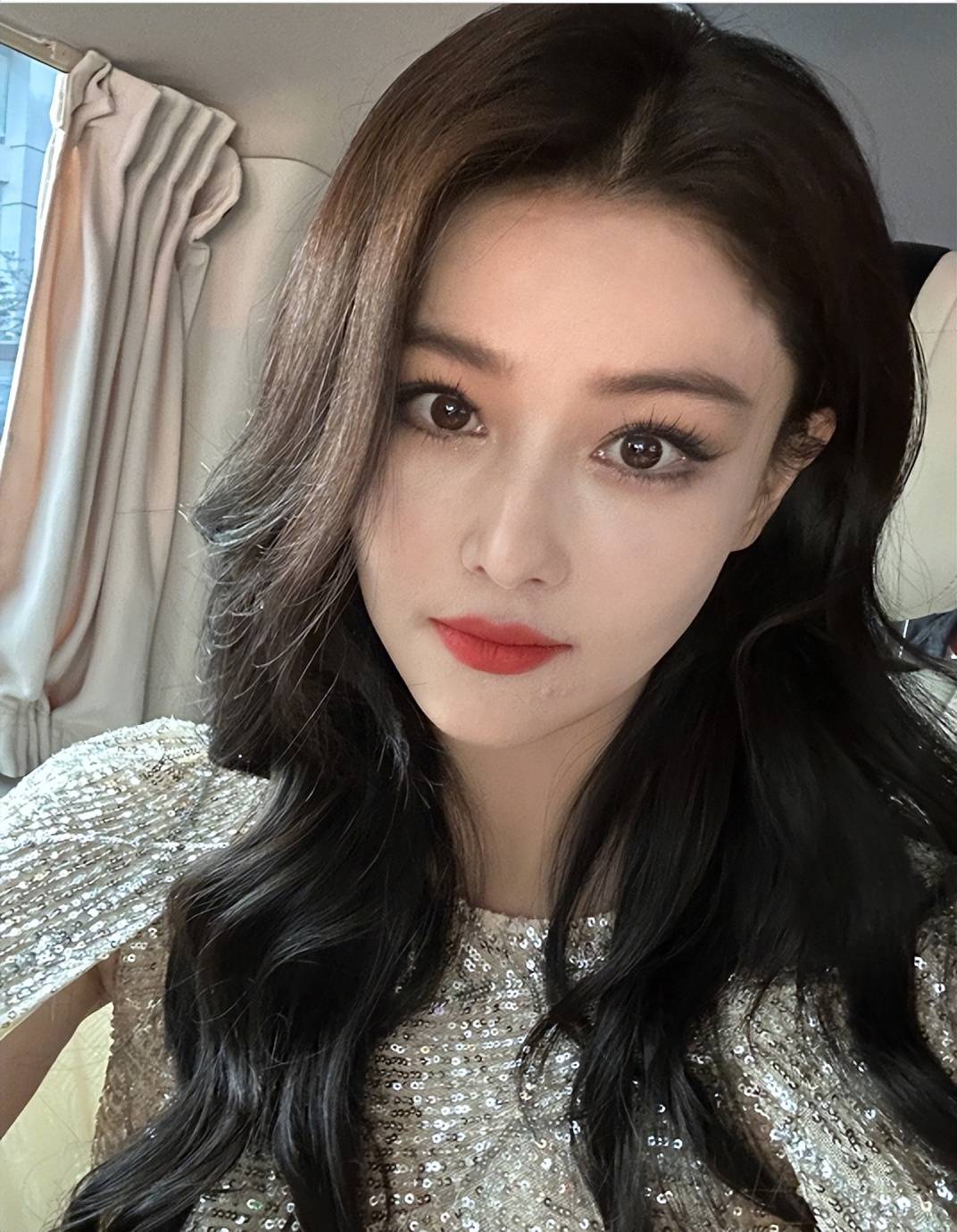 张馨予:到重庆商演,恰逢长了青春痘不仅没有吃上火锅还扎了20针_针灸