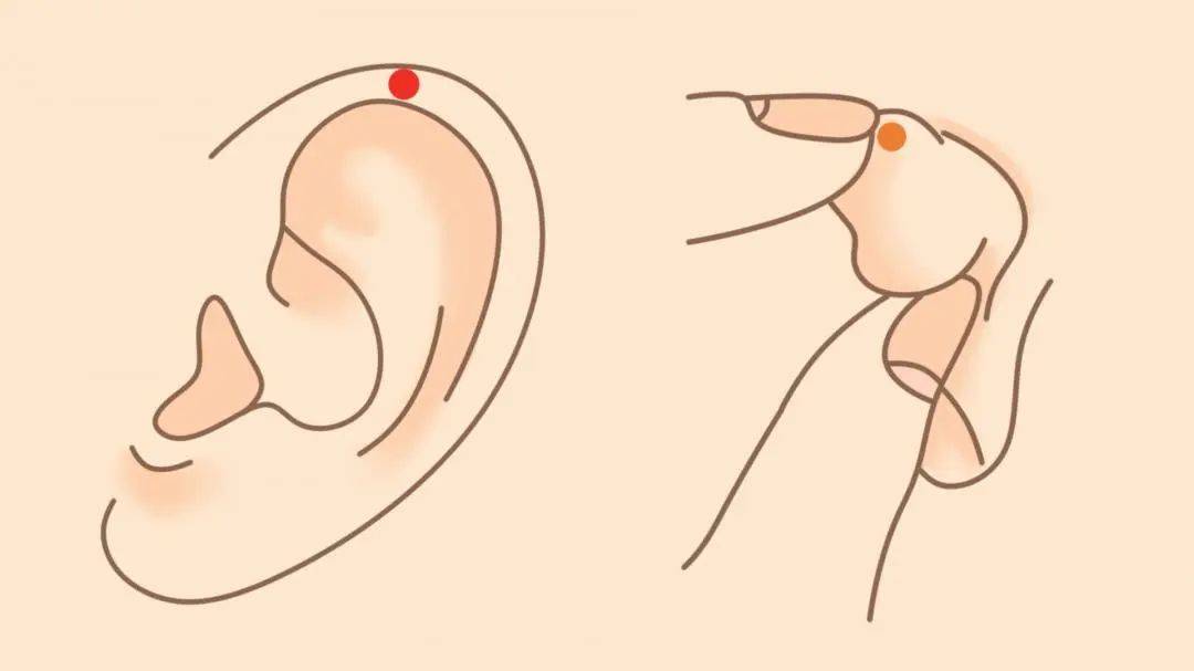 用安尔碘或75%酒精消毒2遍.2.