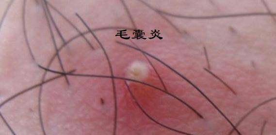 范增_古代_项羽